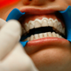 Illustration for article titled Instagram Helped Me Bond With My Dentist Dad by Recommending I Watch Gross Teeth Videosem/em